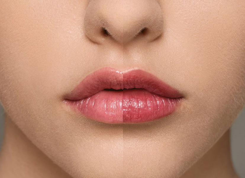 Supreme lip : framboise