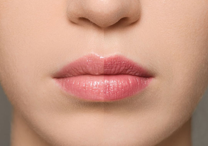 Suprême lip : fraise